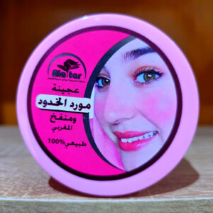 مورد الخدود